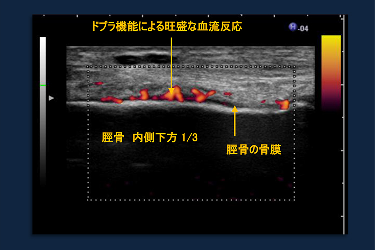 超音波画像診断装置の有用性